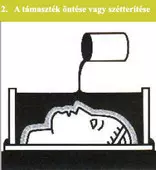 a támaszték öntése, vagy szétterítése