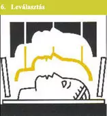 a leválasztás