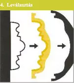 leválasztás